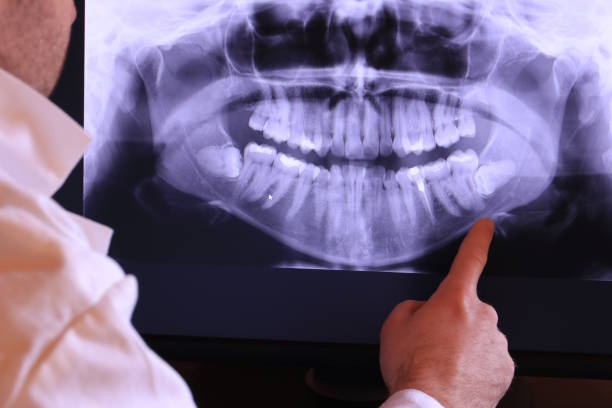 Best Broken Tooth Emergency  in Cohoe, AK